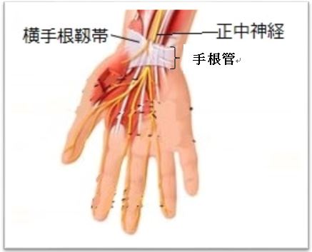 手 根 管 症候群